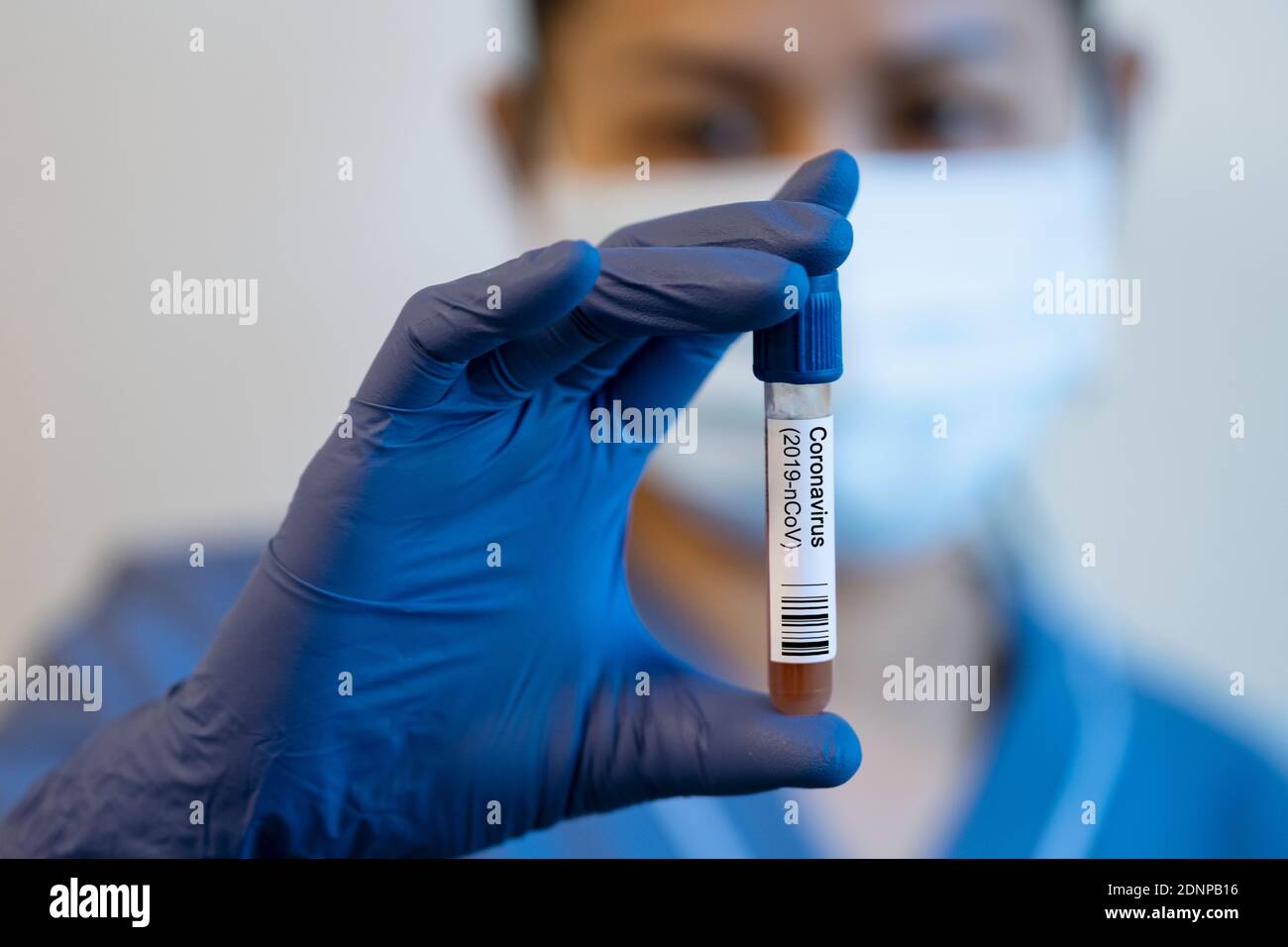 Woman holding blood sample Stock Photo Alamy