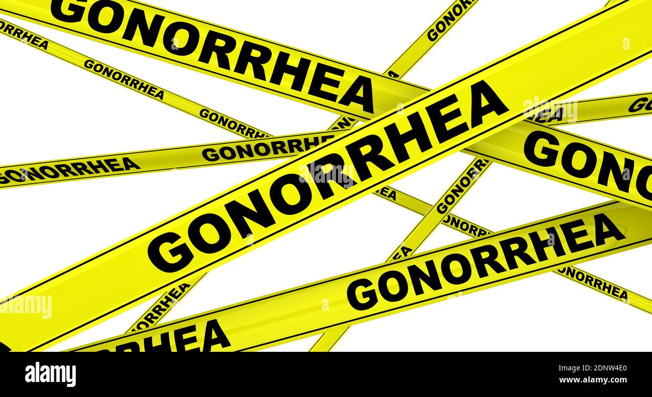 Gonorrhea. Yellow warning tapes with black words GONORRHEA (is a sexually transmitted infection caused by the bacterium Neisseria gonorrhoeae) Stock Photo