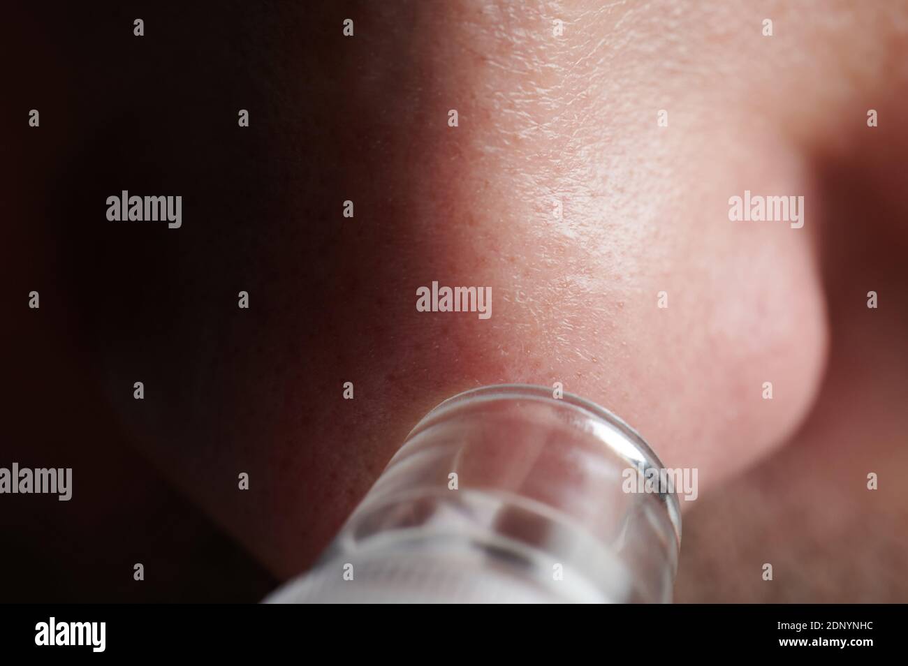 Blackhead skin treatment with cosmetic suction tool macro close up view Stock Photo