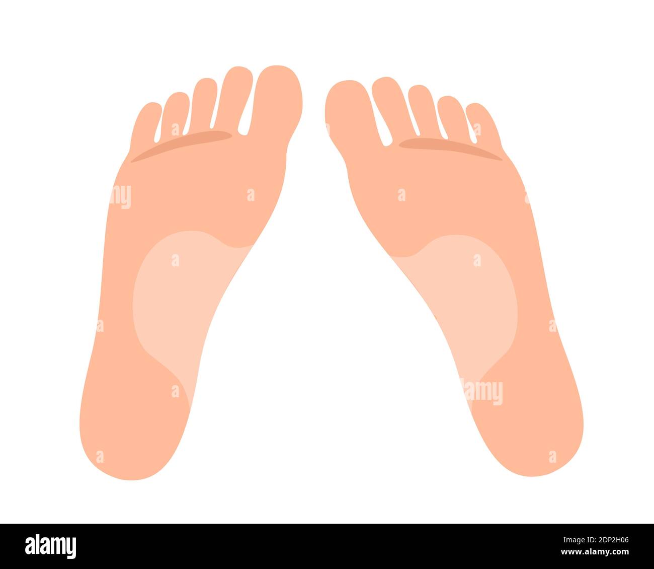 Bowlegs, bowed legs and crooked legs feet are crooked and bowed to