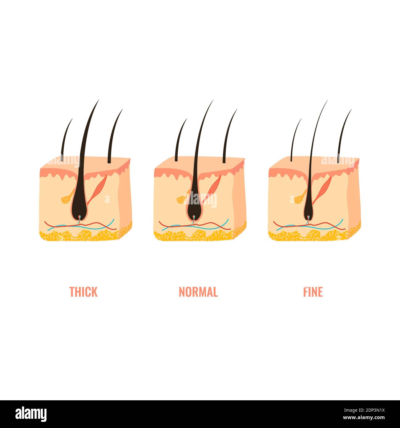 Hair thickness types, illustration Stock Photo - Alamy