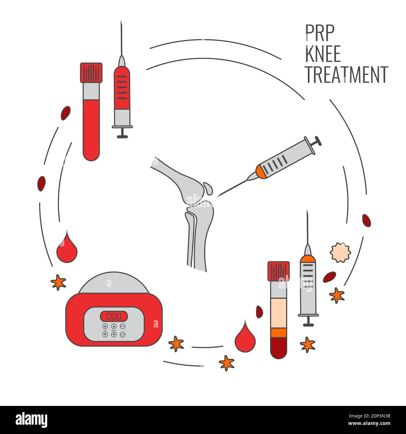 Platelet-rich plasma knee treatment, illustration. Stock Photo