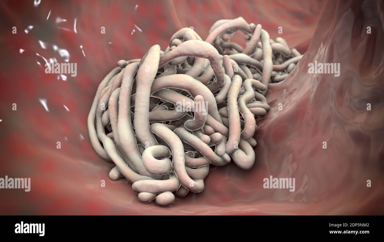 Round worms in human intestine, computer illustration. Roundworms, or nematodes, include numerous free-living and pathogenic species. Nematodes that c Stock Photo