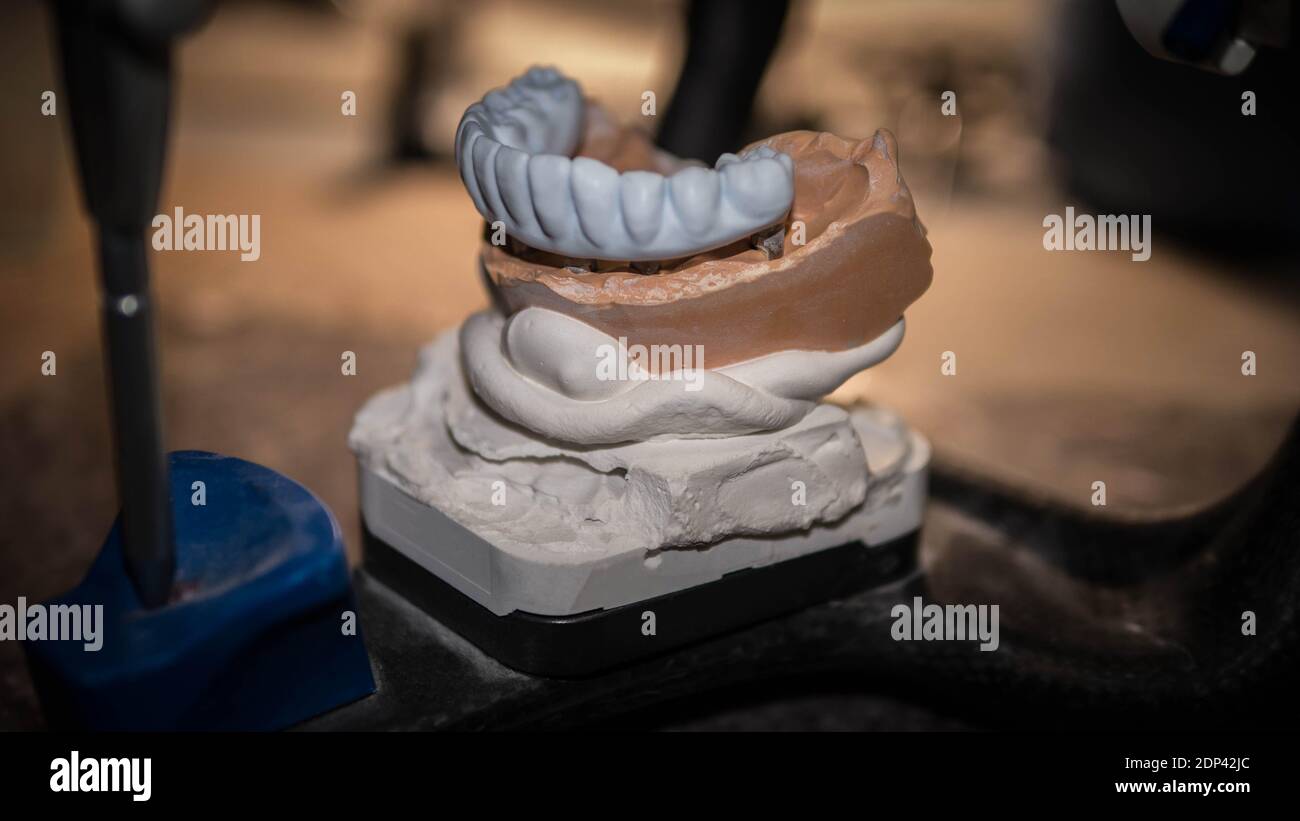 Dental technician tools, dental prosthetics. Dental prosthetics