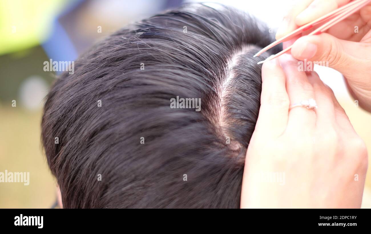 Close-up Of Woman Plucking White Hair From Man Head Stock Photo - Alamy