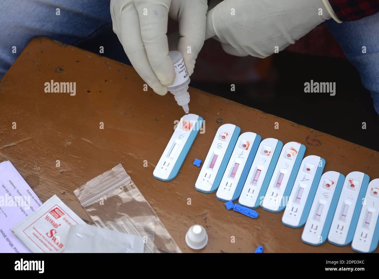 Health workers are testing blood of drivers from different commercial