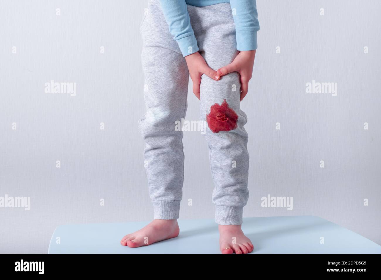 dirty blood stain on children's clothes. daily life dirty stain for