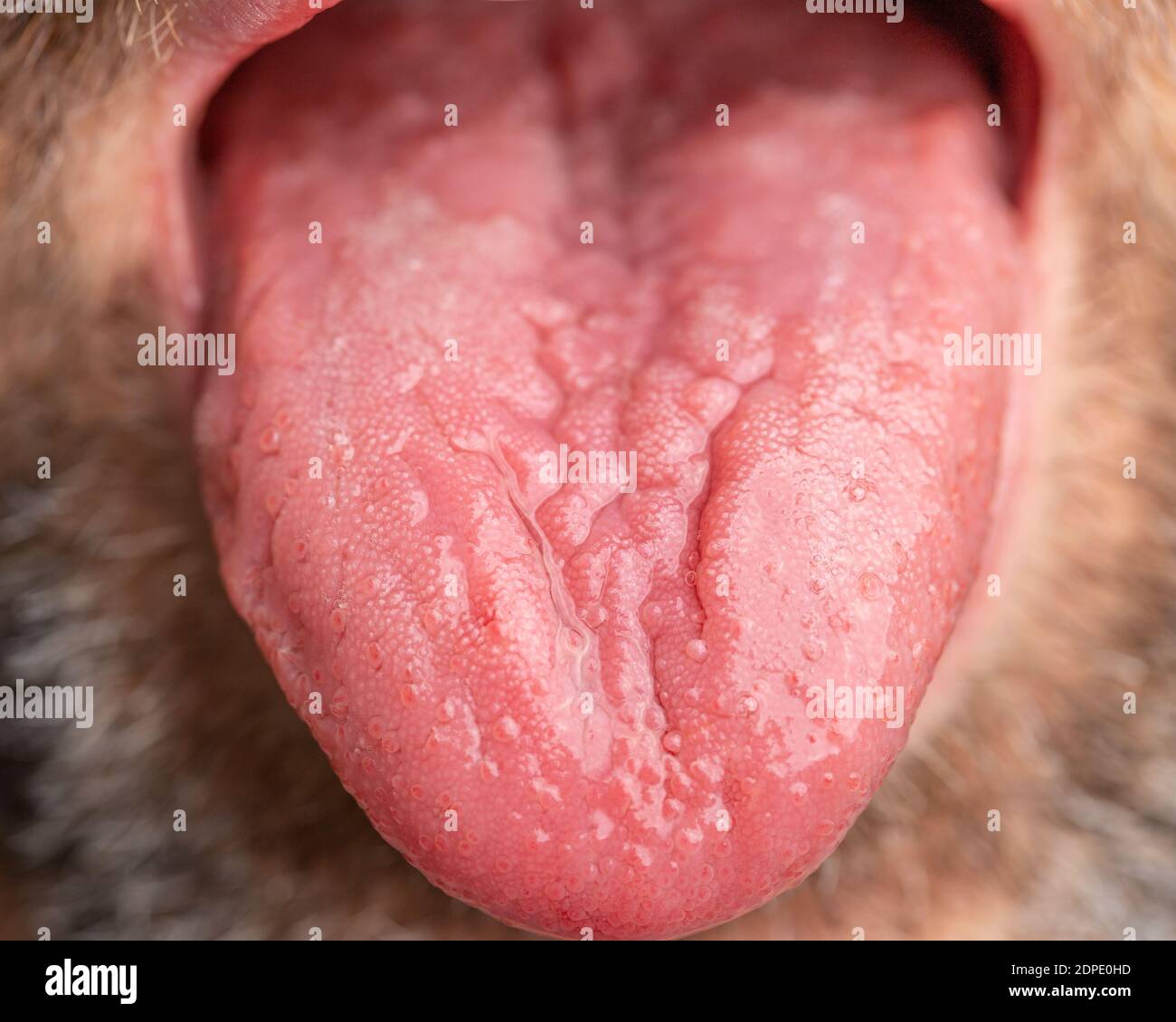 A white male with brown and white facial hair. Tongue is sticking out to show geographic tongue, also known as benign migratory glossitis. Stock Photo
