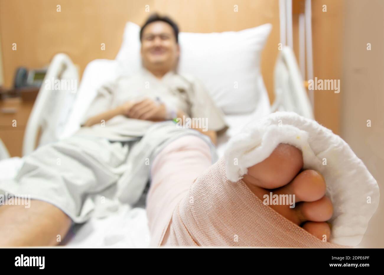 Close-up Of Man With Broken Leg Lying On Bed At Hospital Stock Photo - Alamy