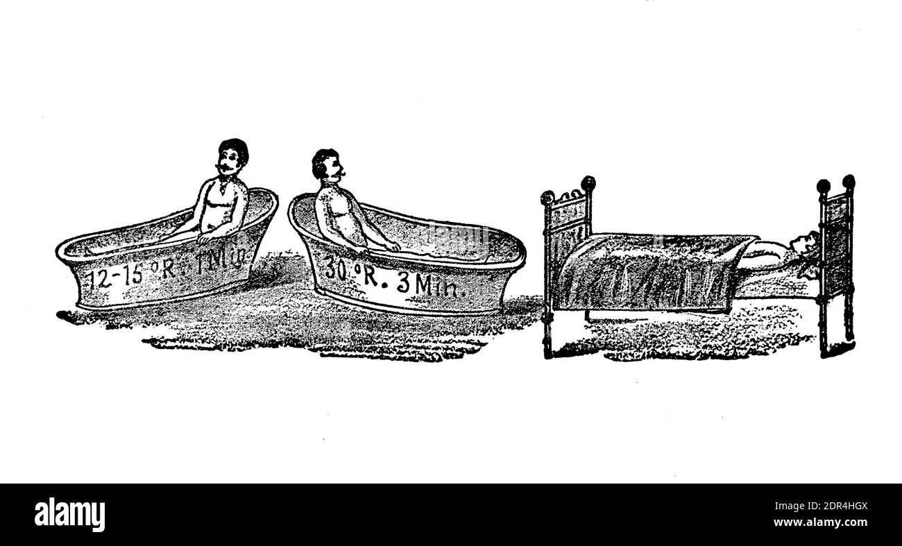 Contrast bath therapy: man taking a bath in different bathtubs alternating hot and cold water several times and then relaxing in bed, 19th century illustration Stock Photo