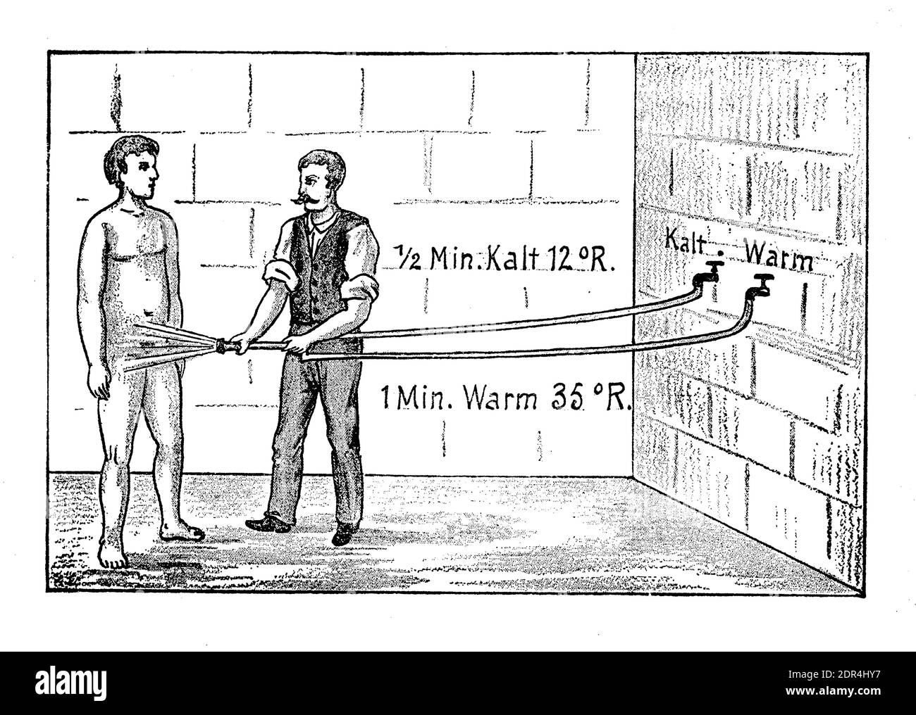 Contrast shower therapy: man taking a shower froma nurse, alternating hot and cold water several times, 19th century illustration Stock Photo