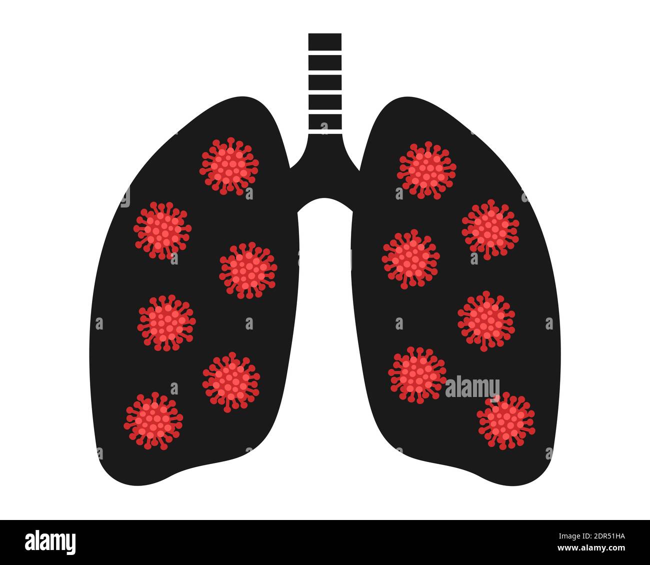Pneumonia and lung cancer disease and illness is damaging internal