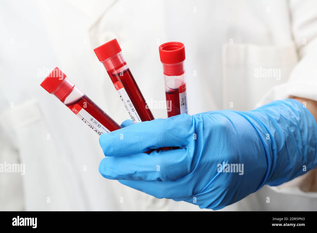blood testing, blood in a test tube, antibody research, testing for the presence of Covid19