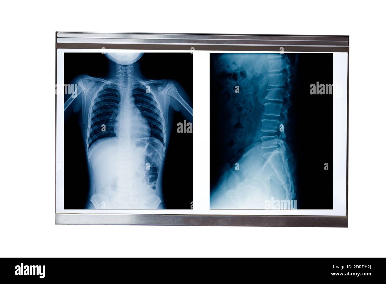 Human skeleton x ray Cut Out Stock Images & Pictures - Alamy