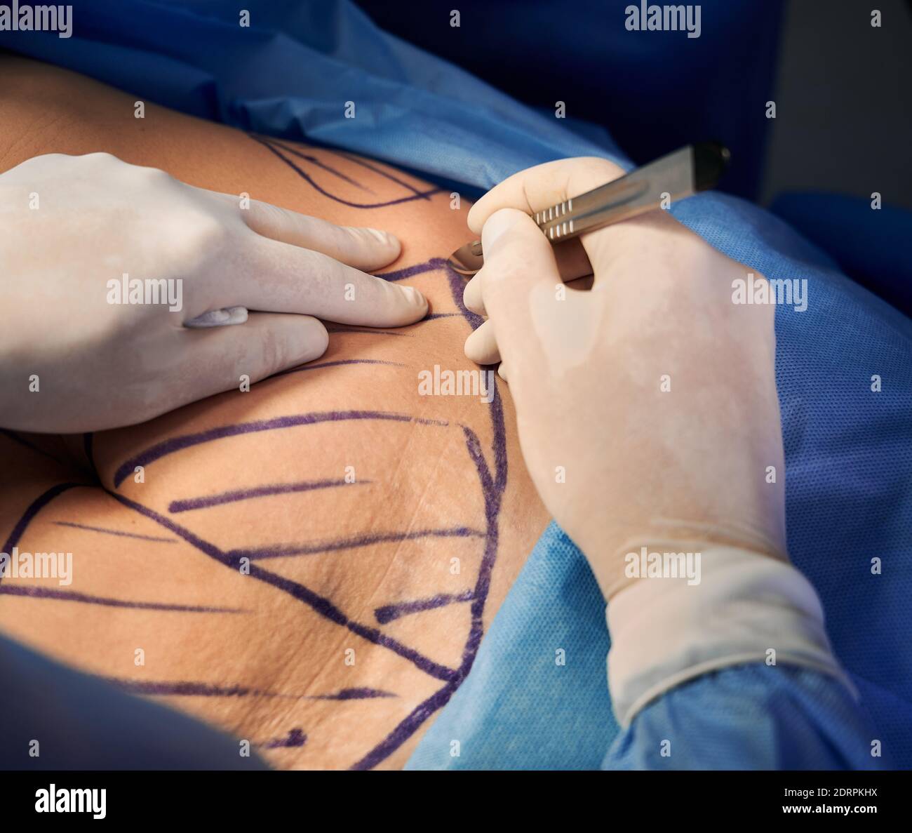 Scalpel Cutting Skin atelieryuwa.ciao.jp