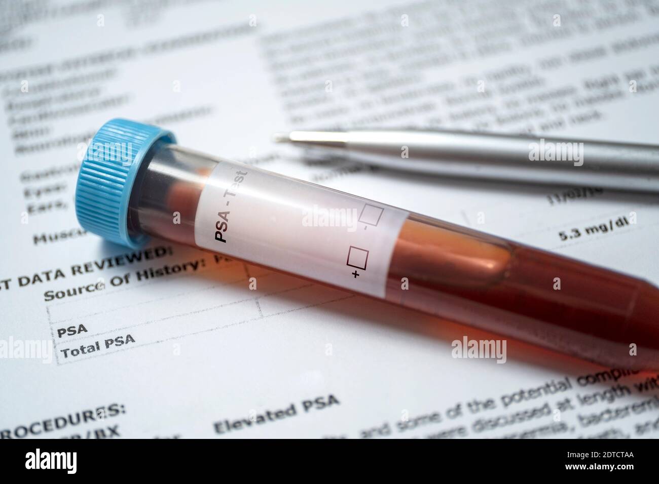 Studio shot of prostate cancer document and blood sample Stock Photo