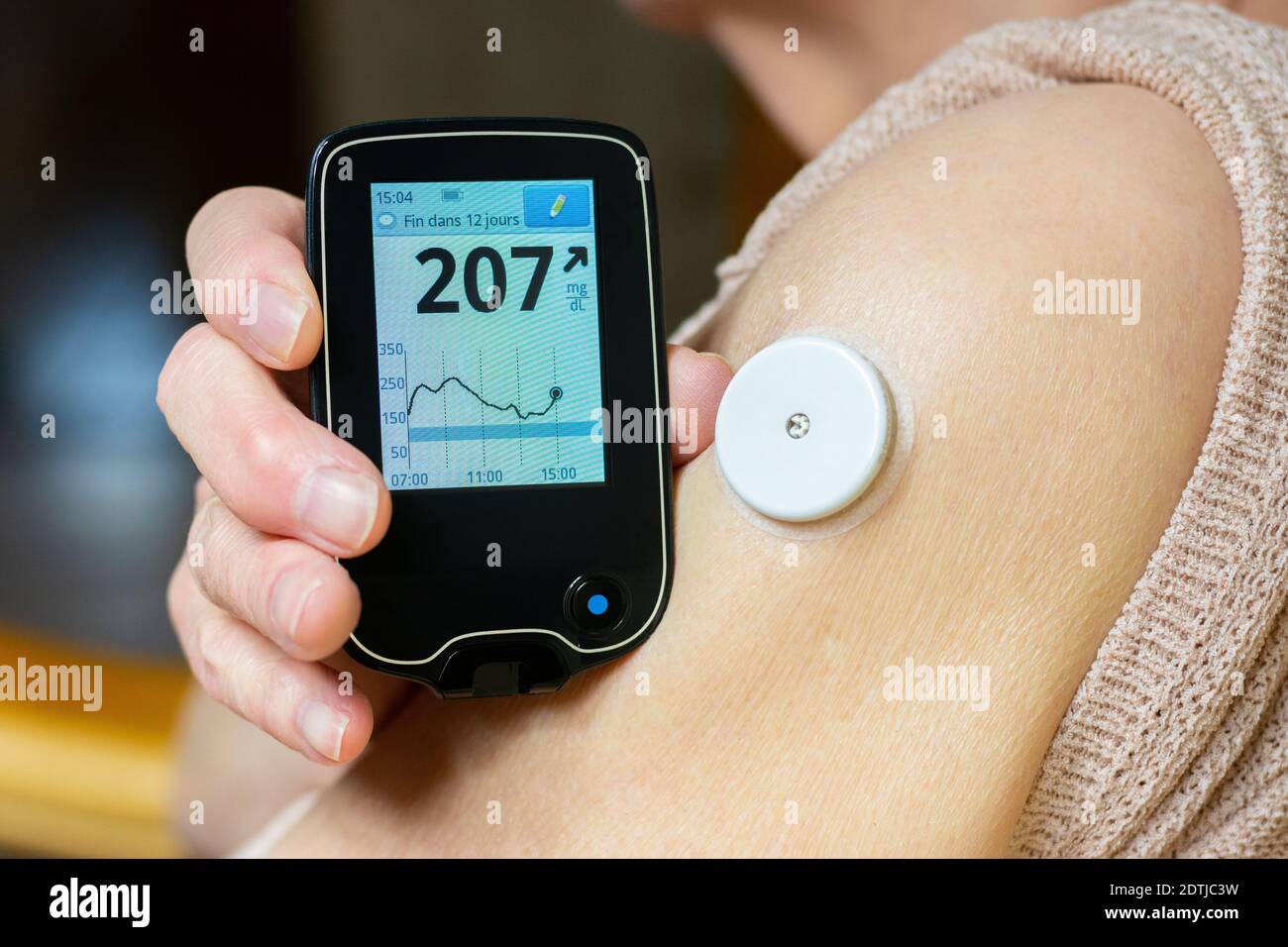 Needle-free blood glucose meter Stock Photo - Alamy