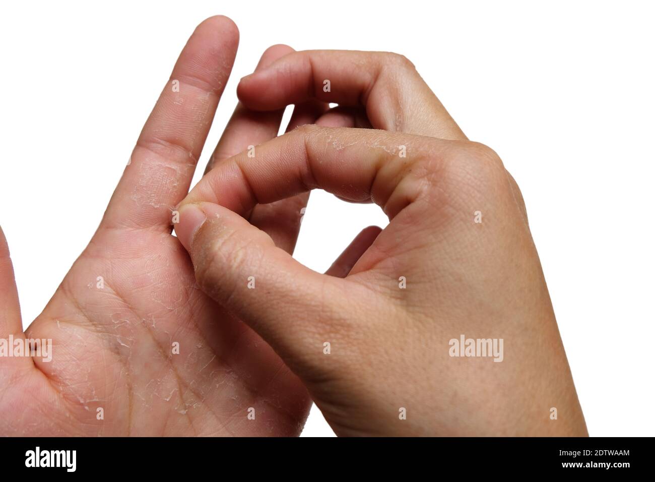 Removing dead skin hires stock photography and images Alamy