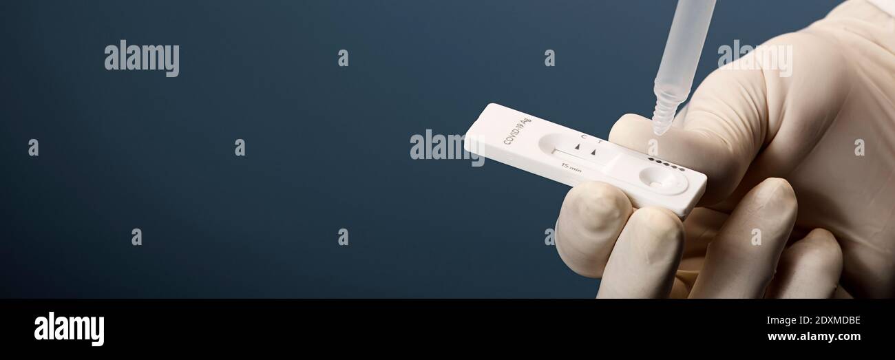 Laboratory Scientist Performing RDT Rapid Diagnostic Test For ...