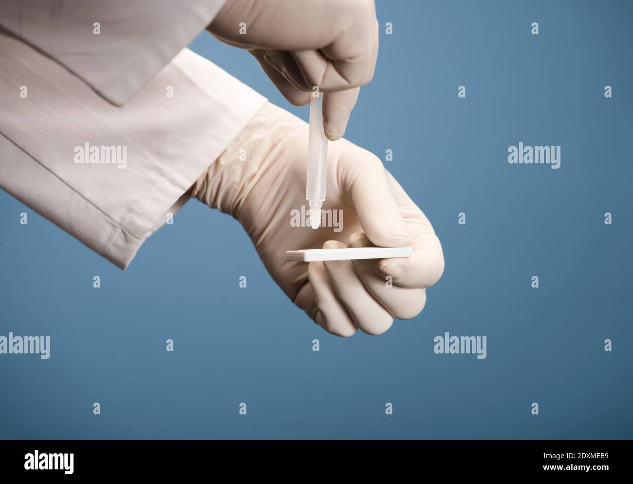 Laboratory Scientist Performing RDT Rapid Diagnostic Test For Antibodies To Detect Presence Of