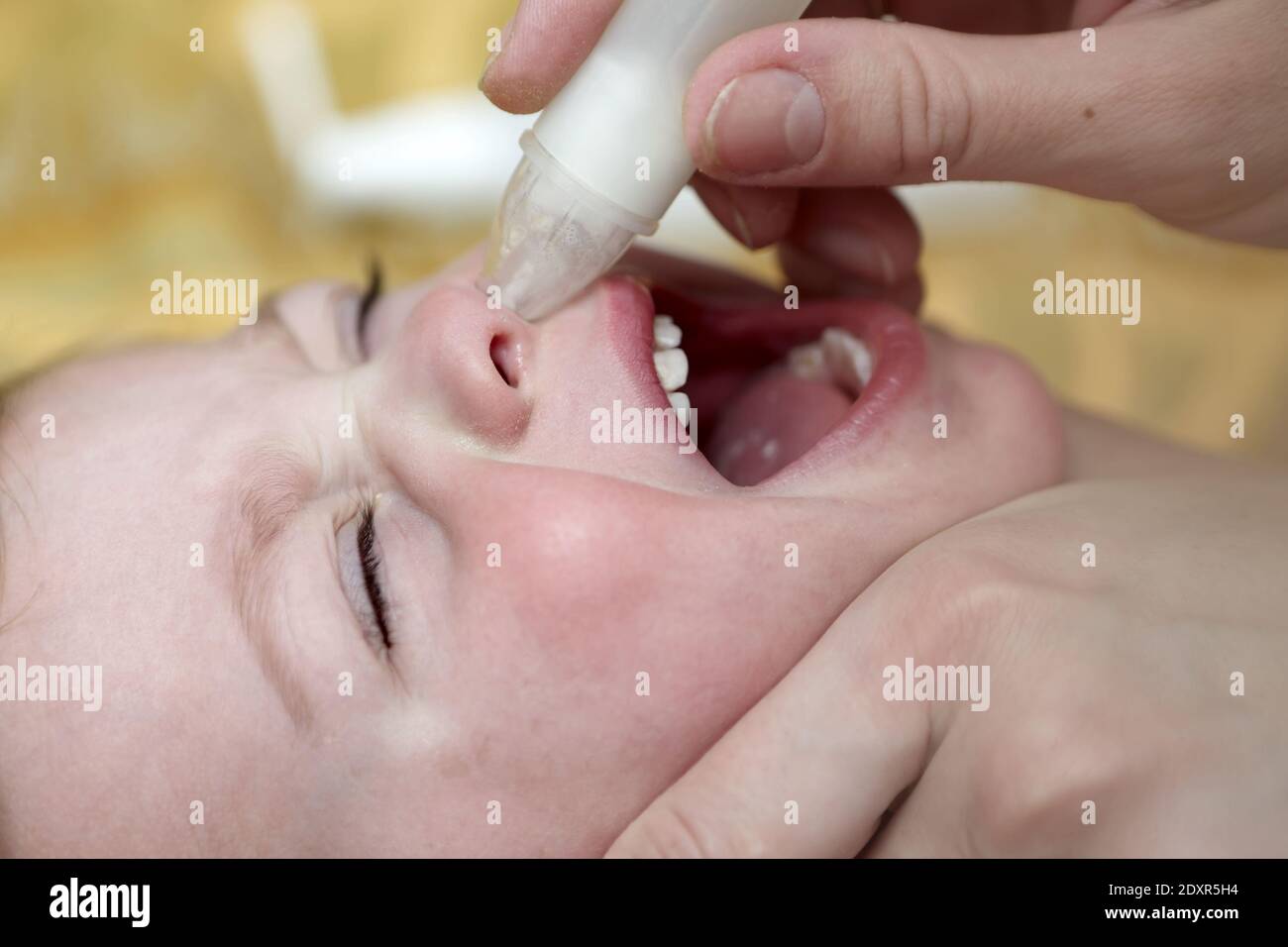 Mother cleaning mucus catarrh of her son nose with nasal aspirator Stock Photo