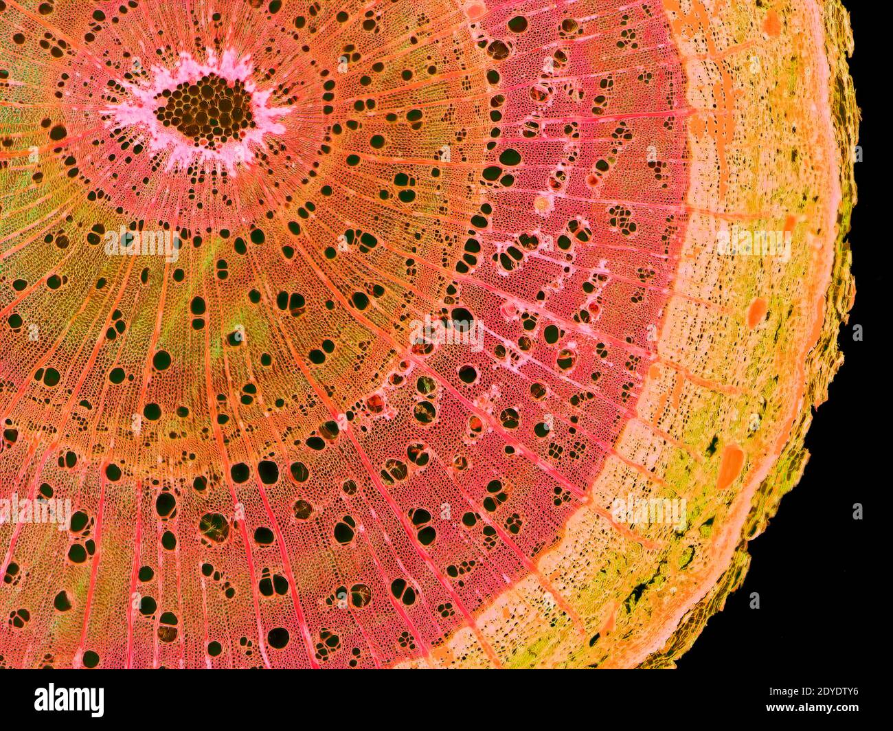 Elm stem. Light micrograph (LM) of a cross-section through a woody stem of an elm (Ulmus procera) tree. Stock Photo