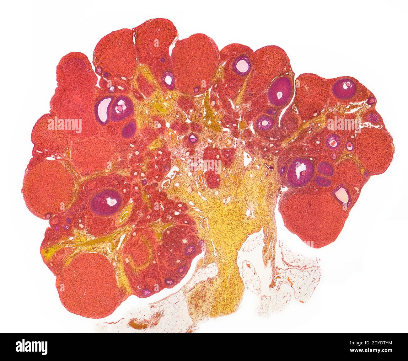 Ovary. Light micrograph (LM) of a section through the whole ovary. Stock Photo