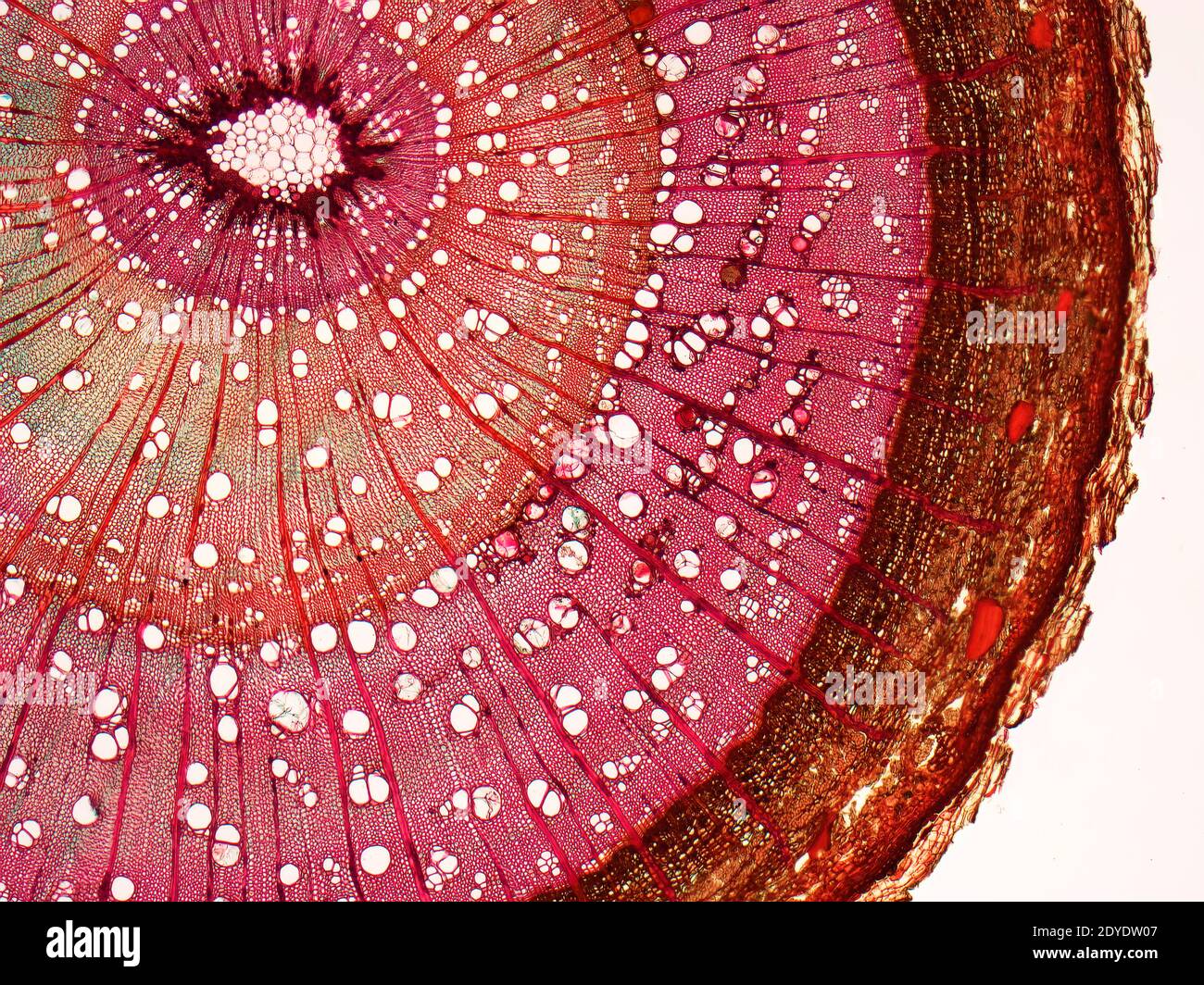 Elm stem. Light micrograph (LM) of a cross-section through a woody stem of an elm (Ulmus procera) tree. Stock Photo