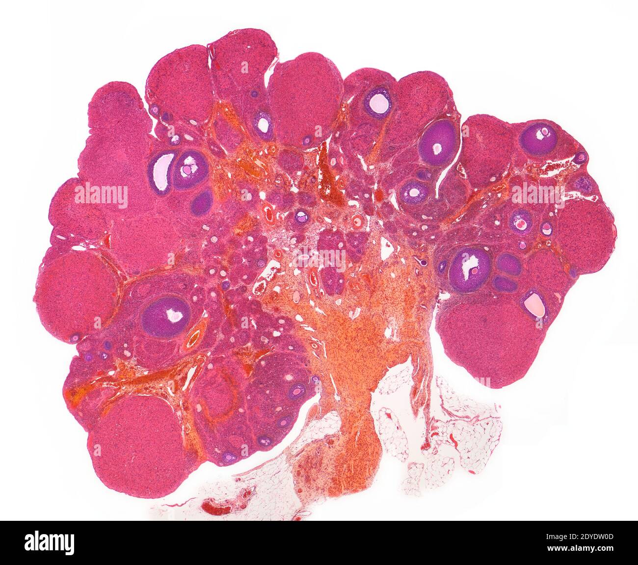 Ovary. Light micrograph (LM) of a section through the whole ovary. Stock Photo