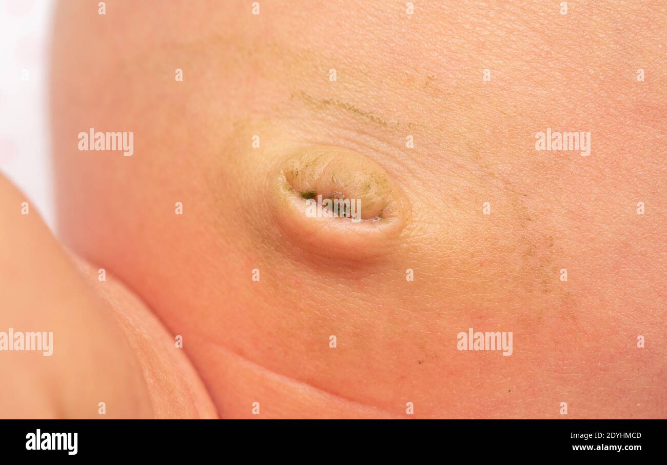 Stomach navel skin hi-res stock photography and images - Alamy
