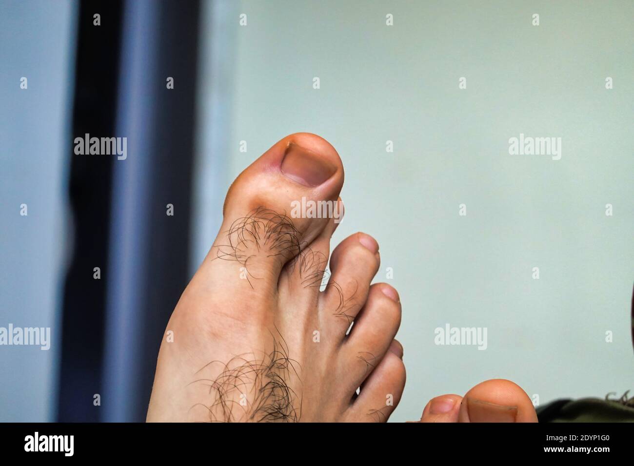 What Causes Hairy Feet At Isabella Embry Blog