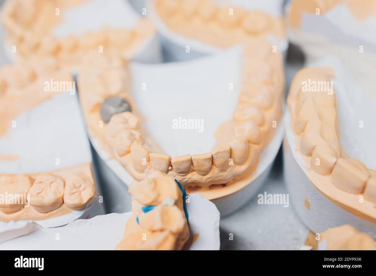 The process of making a dental prosthesis in a dental laboratory Stock ...