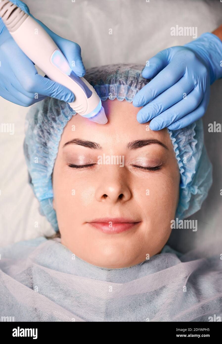 Aquapeel hires stock photography and images Alamy