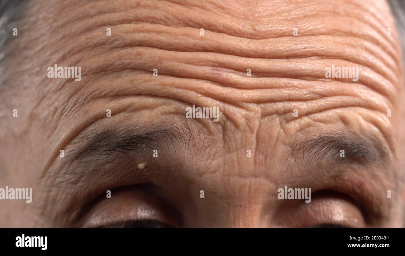 old wrinkled forehead