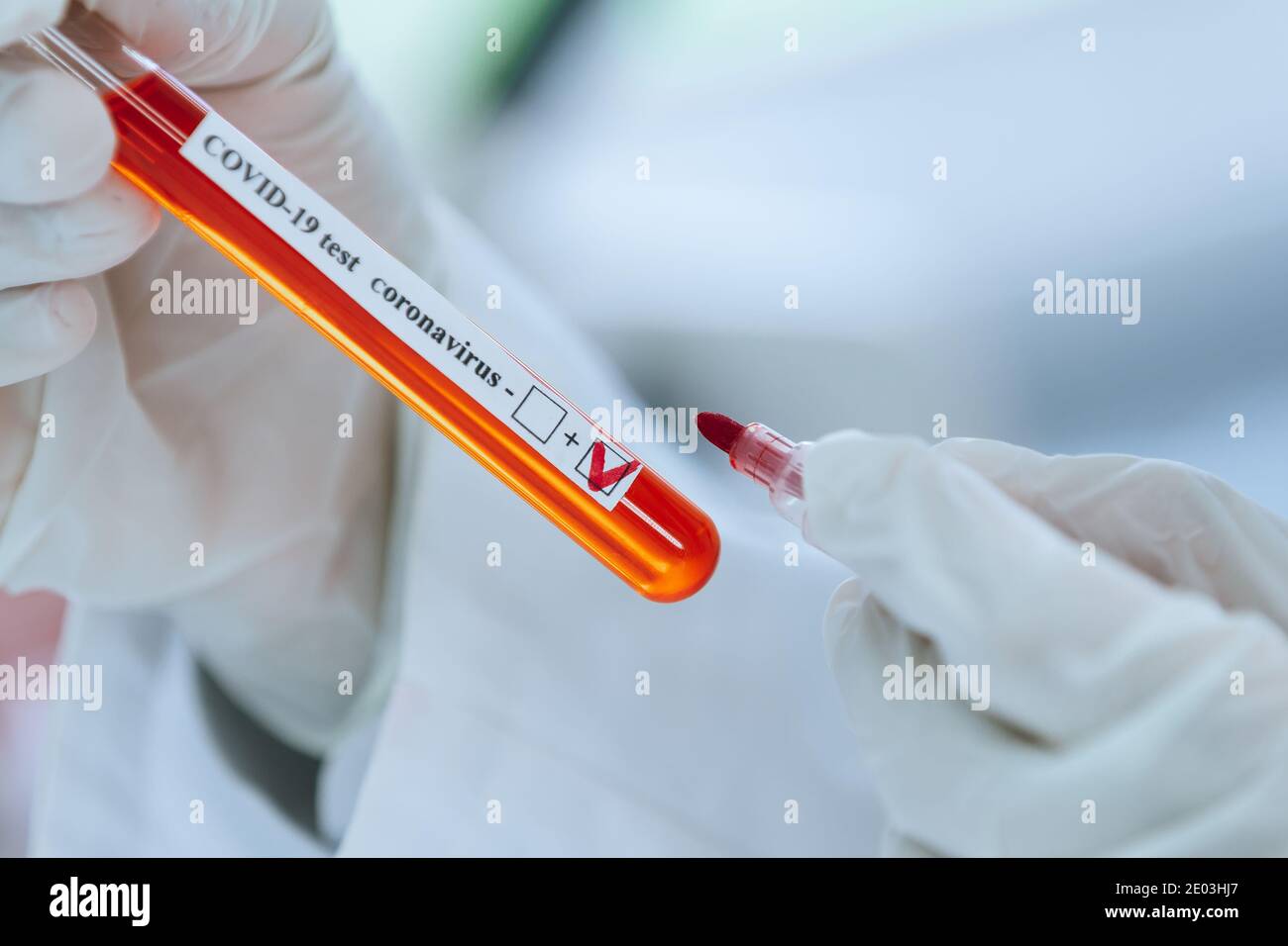 tube with a tested test in the hands of a laboratory employee Stock ...