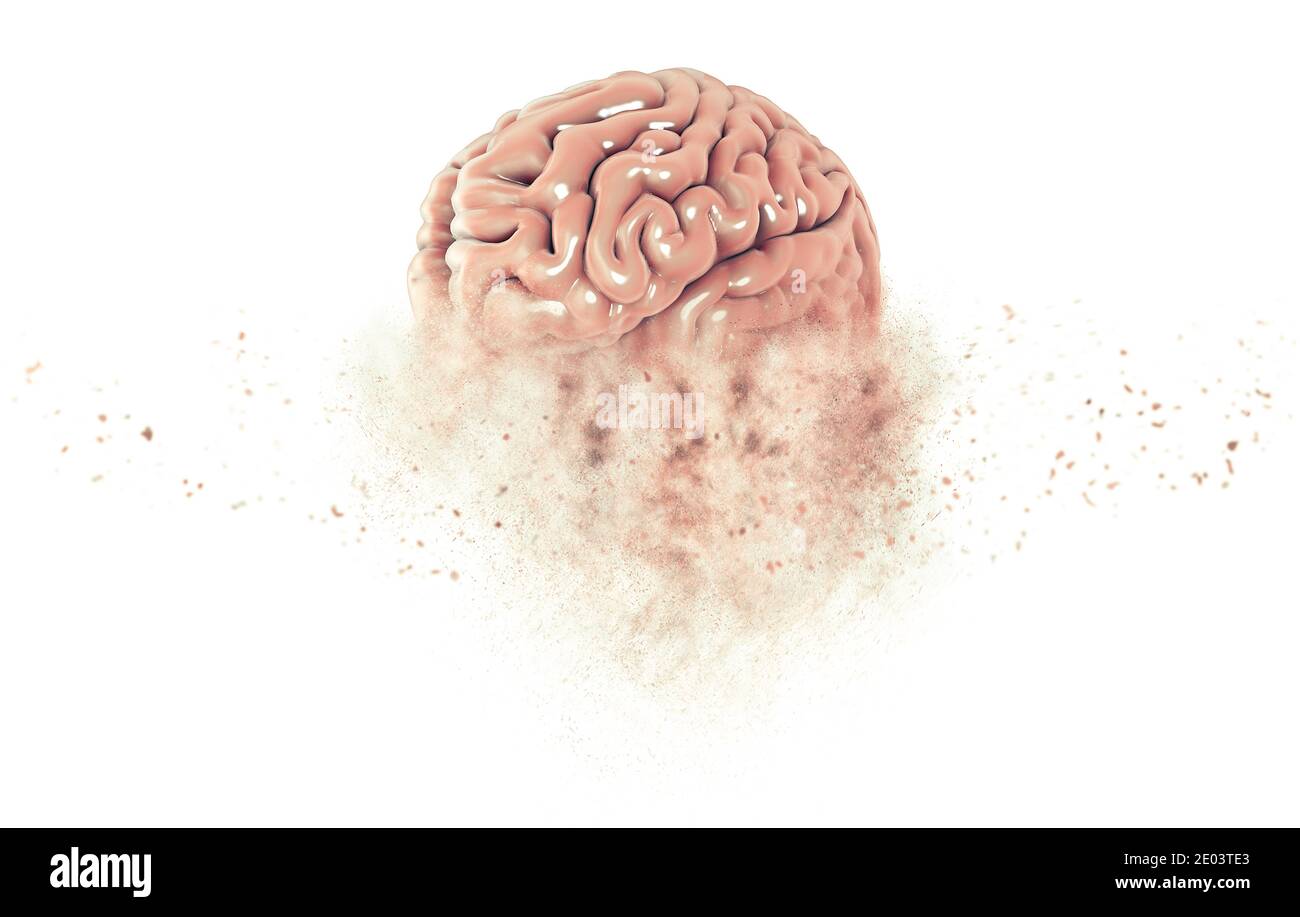 Memory lapses, forgetting things, degenerative disease. Brain problems. Parkinson and alzheimer desease. Mental health. Stroke, synapses and neurnons Stock Photo