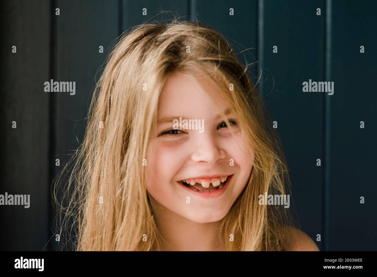 Closeup of a smiling young girl with missing teeth Stock Photo