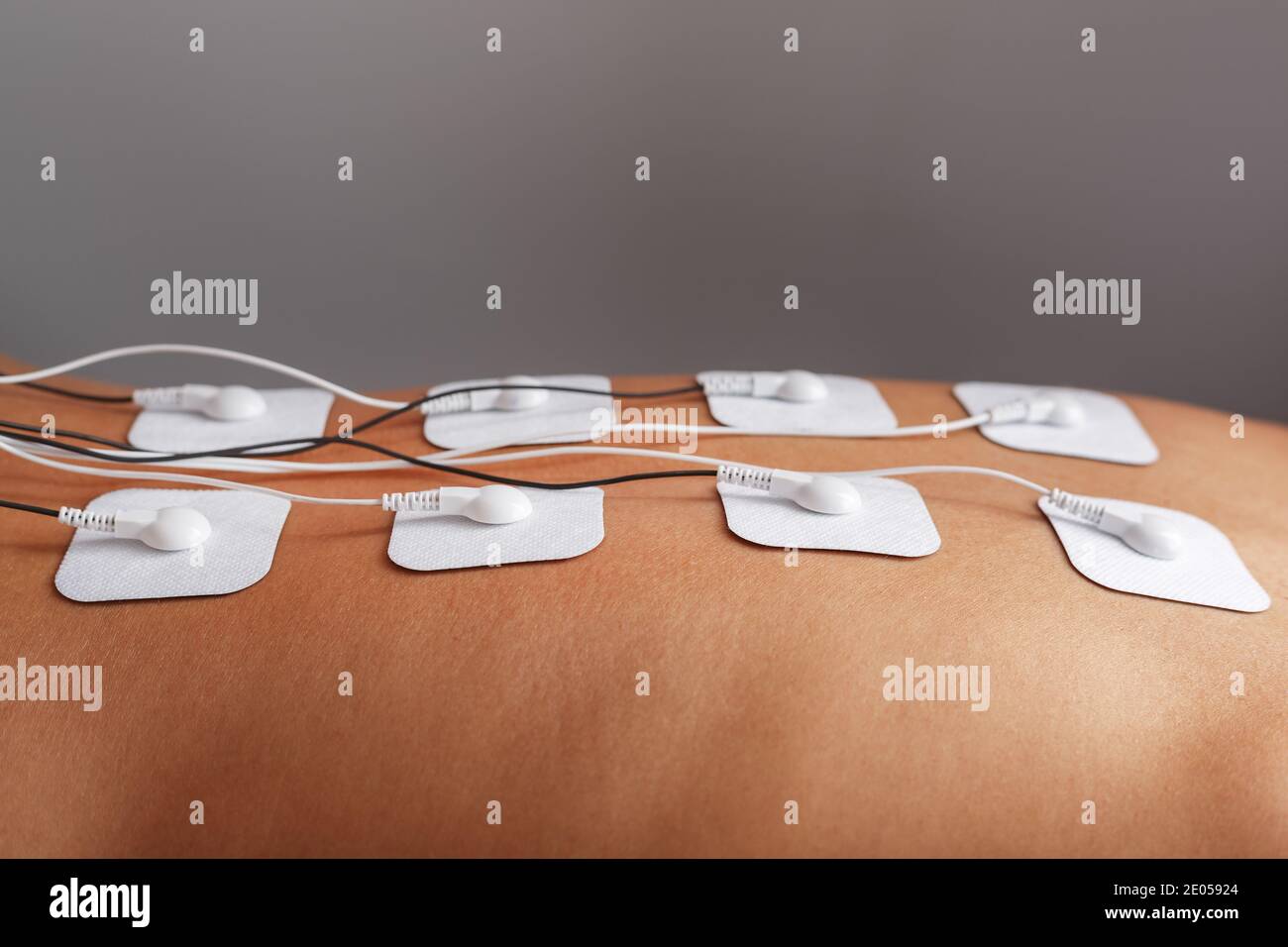 Myostimulation electrodes on a woman's back for massage and