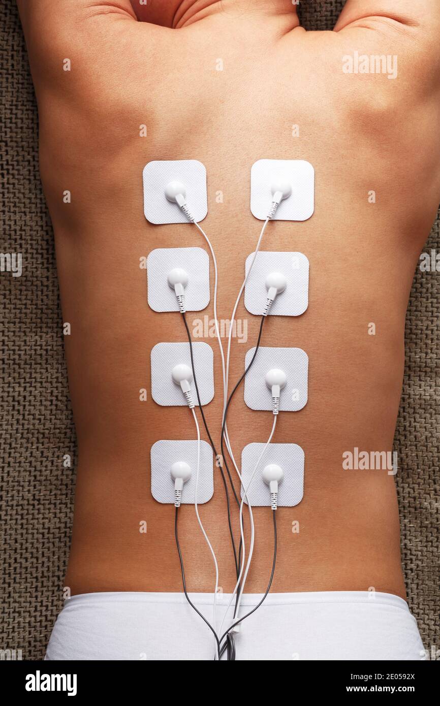 https://c8.alamy.com/comp/2E0592X/myostimulation-electrodes-on-a-womans-back-for-massage-and-rehabilitation-treatment-weight-loss-2E0592X.jpg