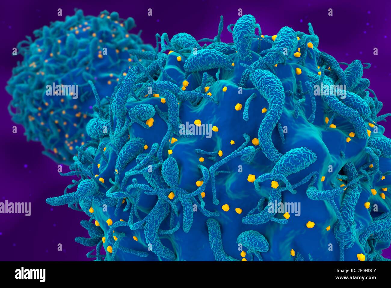 Hiv virus attack and infected t-cell closeup 3d render illustration Stock Photo