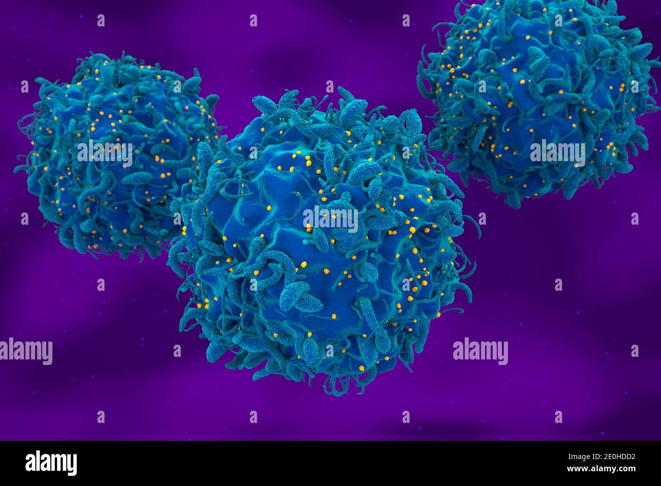 Hiv virus attack and infected t-cell 3d render illustration Stock Photo