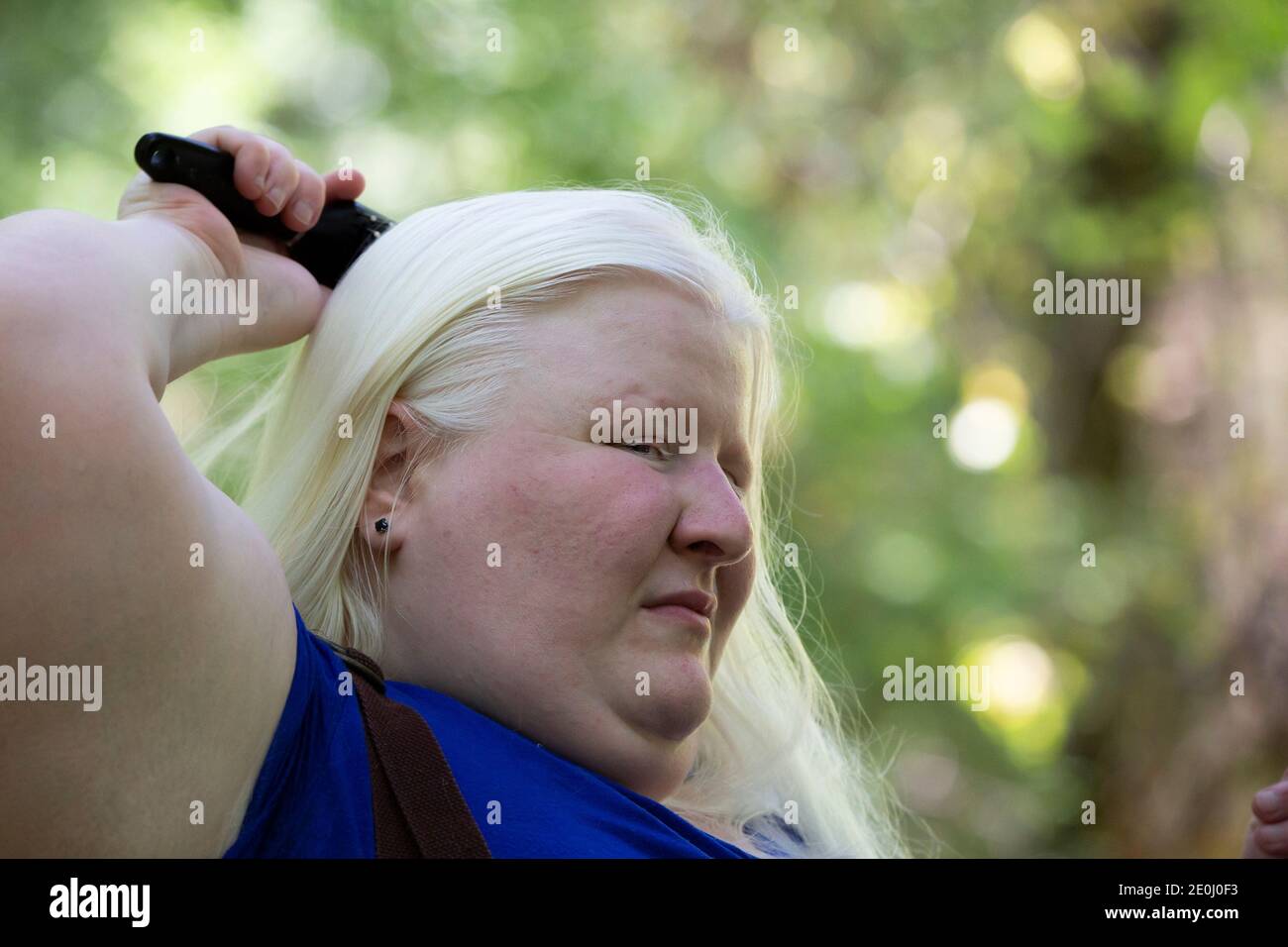 Albino human eye hi-res stock photography and images - Alamy