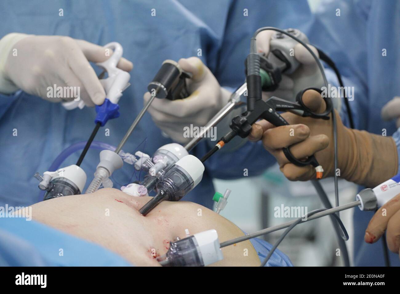 Robot-assisted surgery, Greece Stock Photo