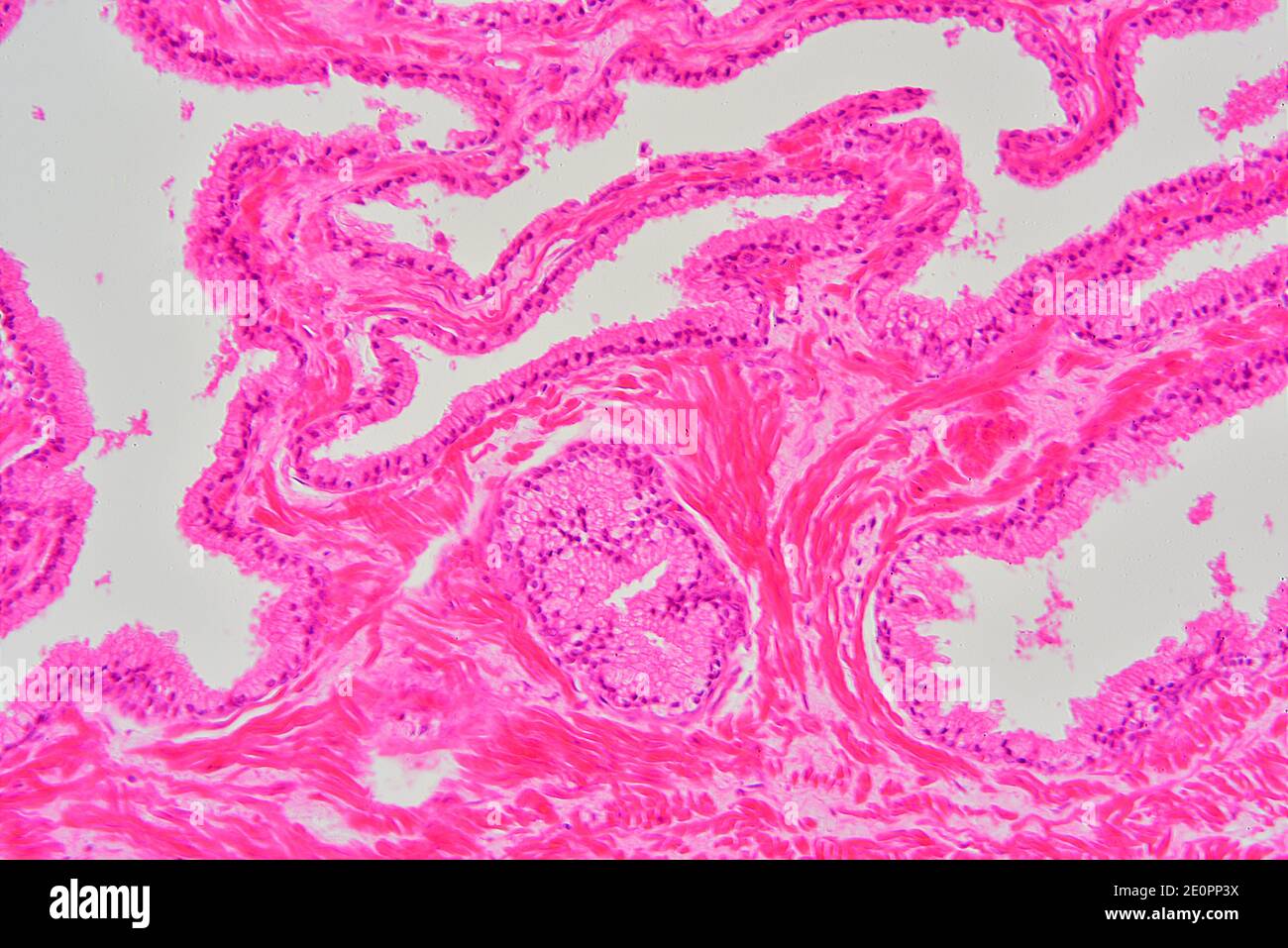 Connective Tissue Light Micrograph High Resolution Stock Photography ...