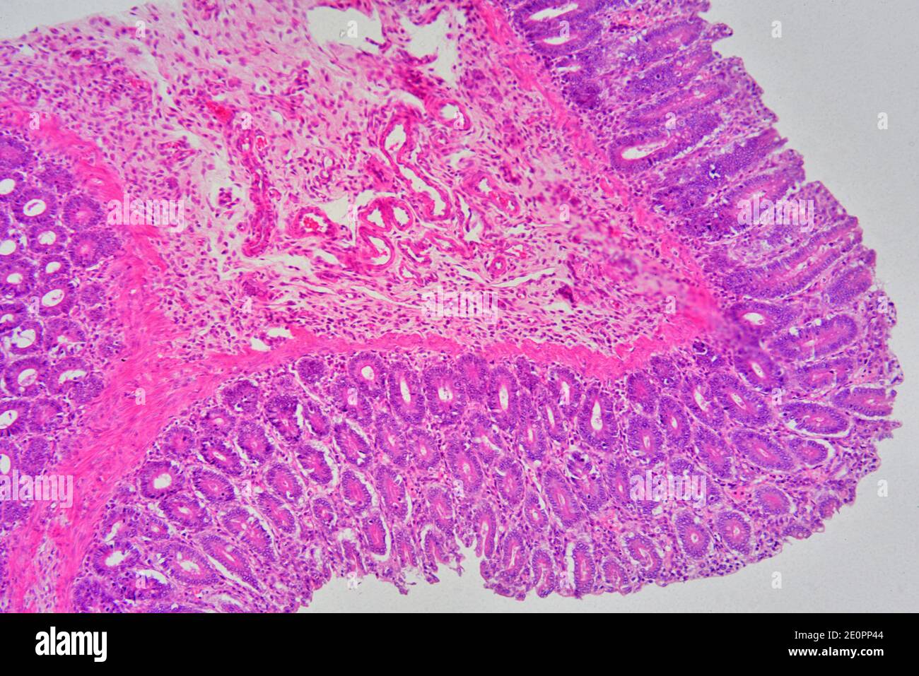 stride Democracy Wreck Human rectum showing from right to left: mucosa with intestinal glands, lamina  propria and submucosa. X75 at 10 cm wide Stock Photo - Alamy