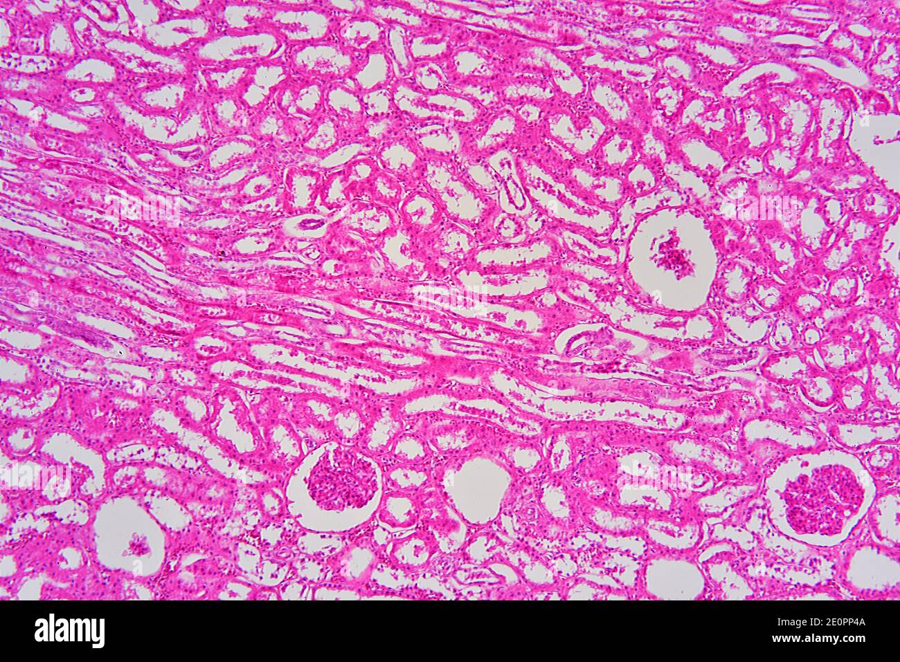 Renal Corpuscle Histology Labeled