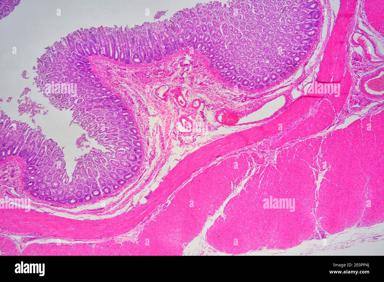 Human rectum with mucosa, intestinal glands, blood vessels and muscular layers. X25 at 10 cm wide. Stock Photo