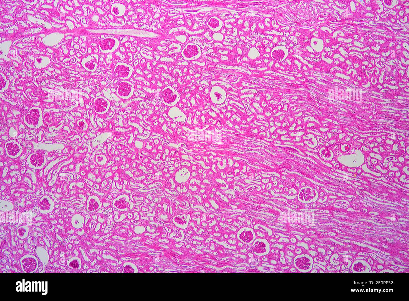 Human kidney section with injected blood showing glomeruli, Malpighian corpuscles and parenchyma. X25 at 10 cm wide. Stock Photo
