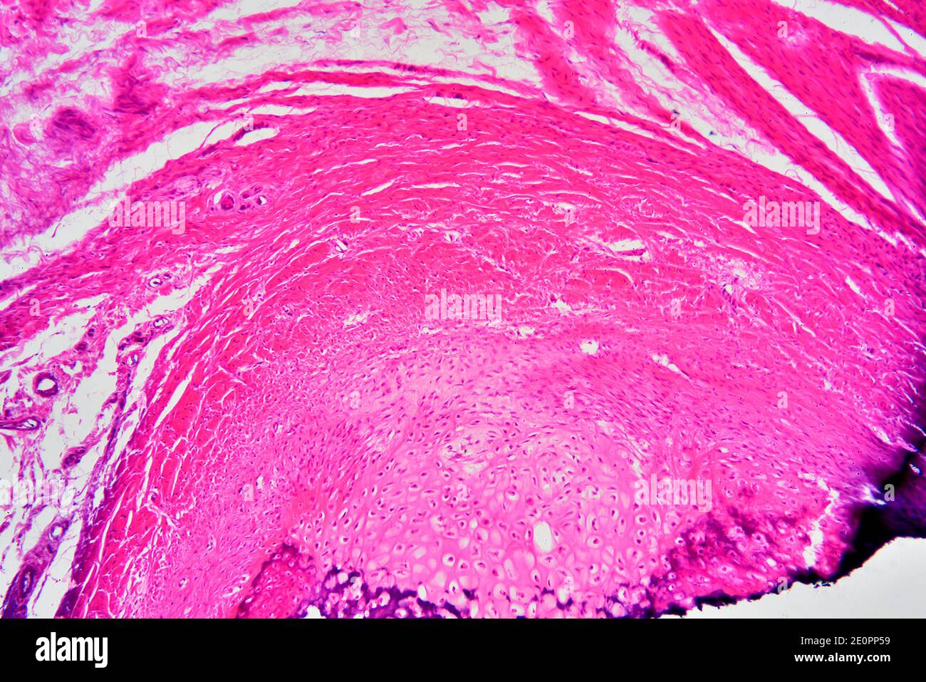 Developing infant bone. X75 at 10 cm wide. Stock Photo