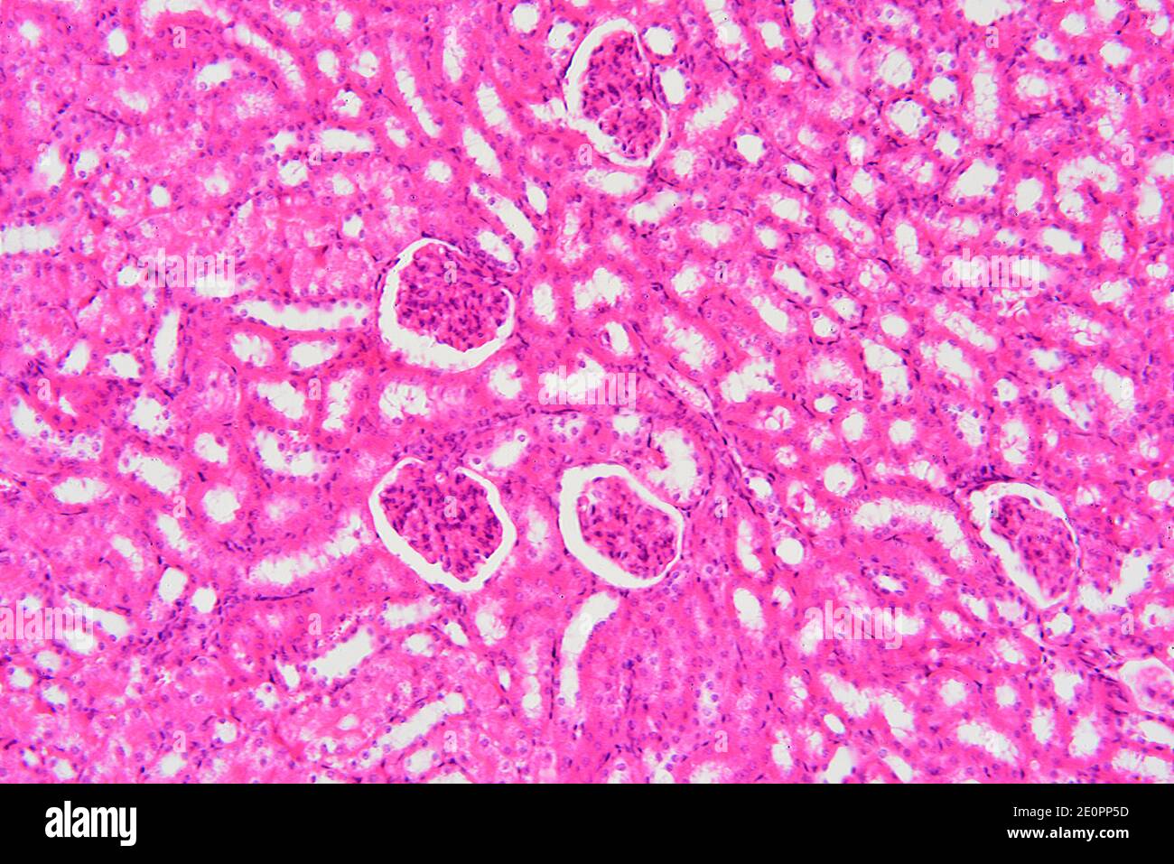 Human kidney section showing glomeruli, Malpighian corpuscles and parenchyma. X125 at 10 cm wide. Stock Photo
